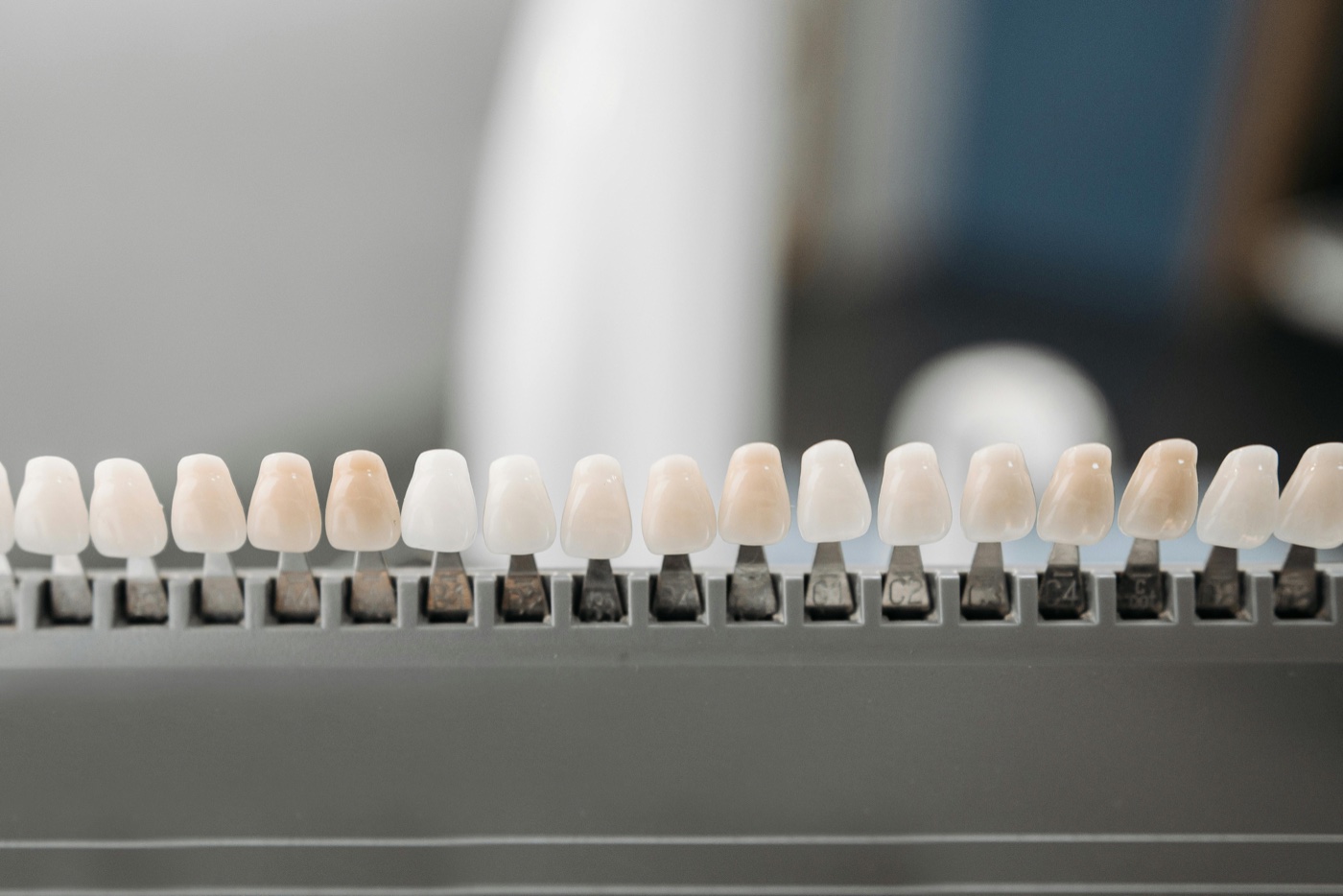Escala de tonalidades para facetas dentárias