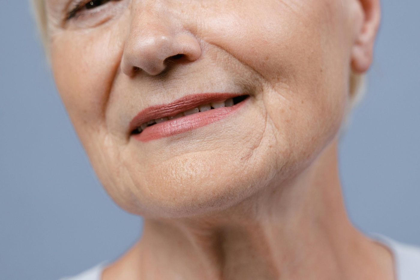 Paciente em tratamento estético facial